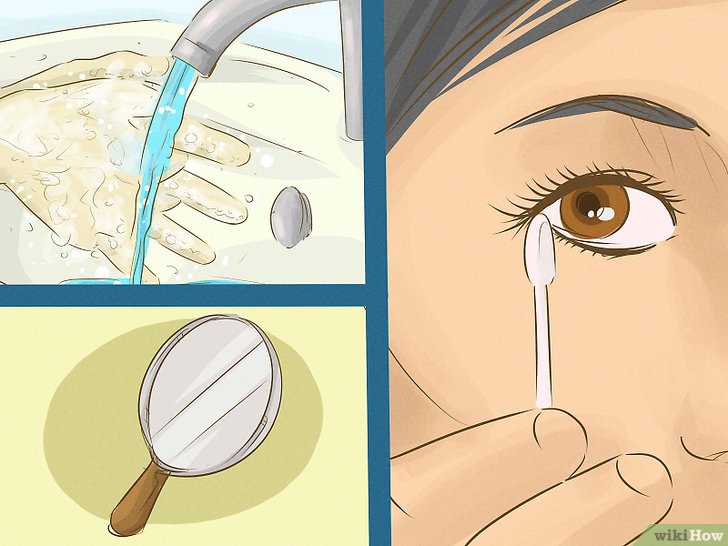Cách lấy mạt sắt trong mắt an toàn 