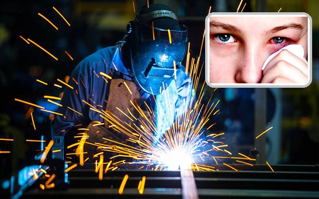 Cách lấy mạt sắt trong mắt an toàn 