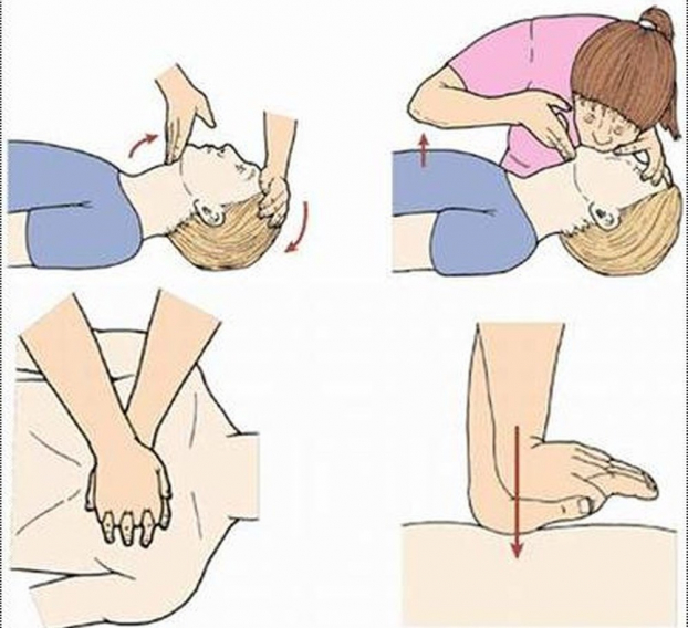 Cách sơ cứu khi bị điện giật – những điều bạn cần biết